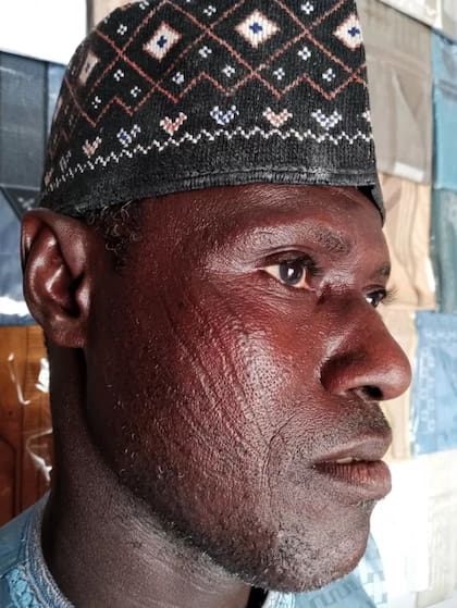 La violenta práctica a niños que es vista en África como símbolo de orgullo y belleza.