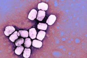 La viruela era causada por el virus variola.