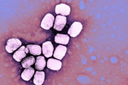 La viruela se erradicó en 1980