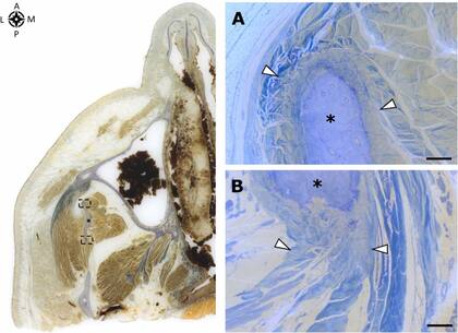 La vista inferior de una sección transversal incrustada en MMA, que muestra las entesis del músculo temporal y la parte coronoide del masetero en la apófisis coronoides