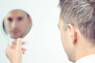 "Pasé de ser el pelado a poder usar jopo"