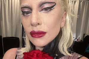 Lady Gaga, criticada por una “vergonzosa” campaña de promoción de medicamentos para la migraña