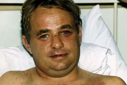 Lancaster, con visibles marcas en la piel causadas por los golpes y el viento helado