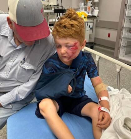 Lane Lambert de cinco años resultó con traumatismos en su cara y sus brazos