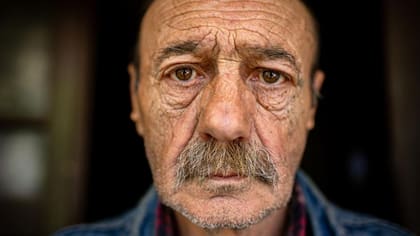 Las arrugas profundas no pueden ser combatidas con gelatina