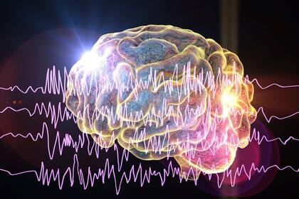 Las ataques de epilepsia son provocados por ráfagas anormales de actividad eléctrica en el cerebro, las cuales provocan que el cuerpo se mueva sin control.