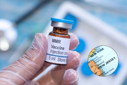 Las autoridades sanitarias de Nueva Jersey alertaron a la población sobre un caso de sarampión; el 90% de las personas no vacunadas se contagian de esta enfermedad