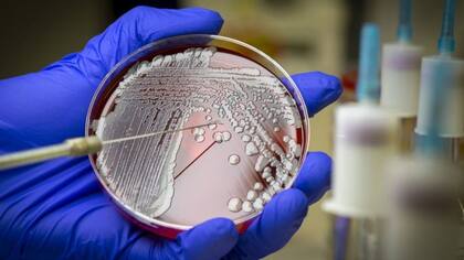 Las bacterias se cultivan en el laboratorio