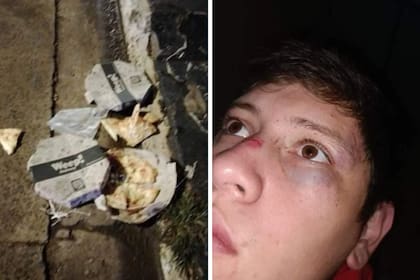 Las cajas de pizza destruidas por el empresario y la cara del joven de 23 años que fue víctima de la golpiza