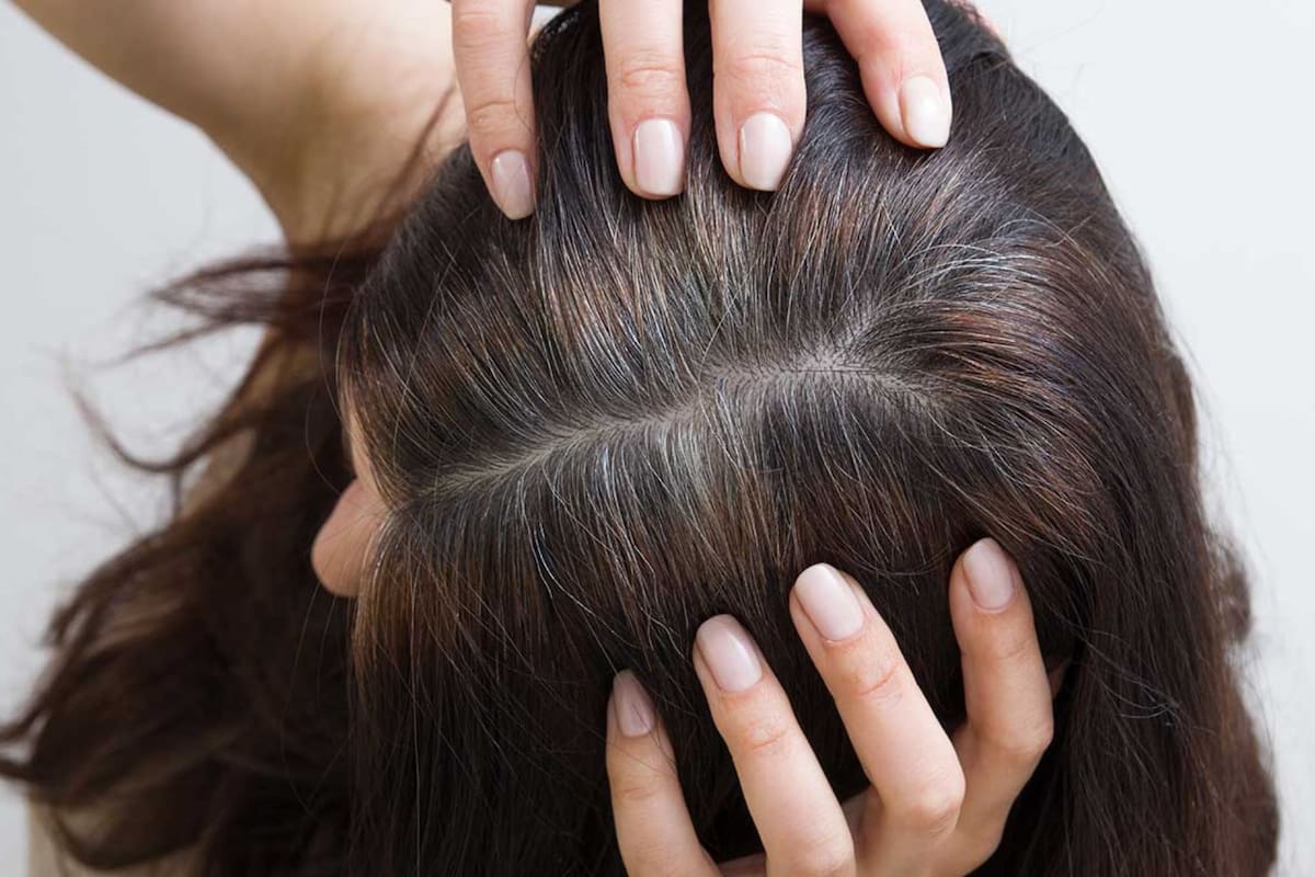 La vitamina que ayuda a prevenir las canas