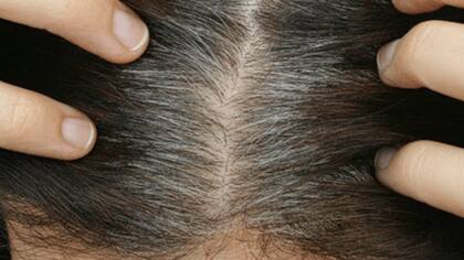 Las canas prematuras, identificadas por un gen