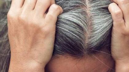 Las canas pueden aparecer con los años