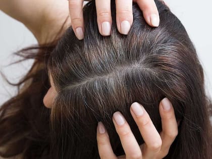 Las canas son cabellos que perdieron su pigmentación, volviéndose blancos o grises