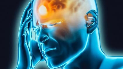 Las cefaleas en racimo son poco comunes