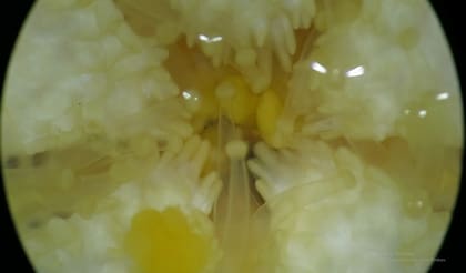 Las crías de estrella de mar en el estómago de la madre