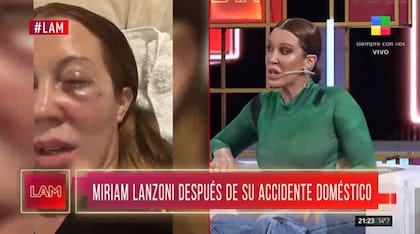 Las dolorosas heridas de Miriam Lanzoni