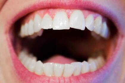 Las encías, cuando están sanas tienen ciertas características: color rosado, consistencia firme, ausencia de inflamación y no sangran.