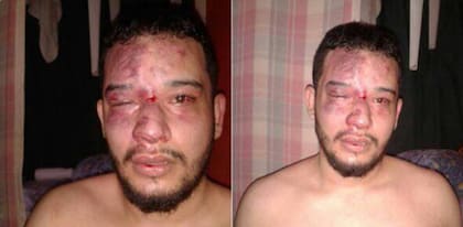 Las fotos del rostro golpeado de Sanabria rápidamente se viralizaron en redes sociales, lo que causó repudio