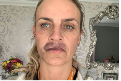 Las fotos que compartió la mujer en sus redes para denunciar la academia en donde compró el servicio coméstico