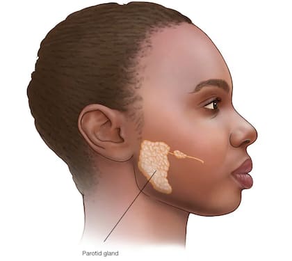 Las glándulas parótidas se ubican delante de cada oreja