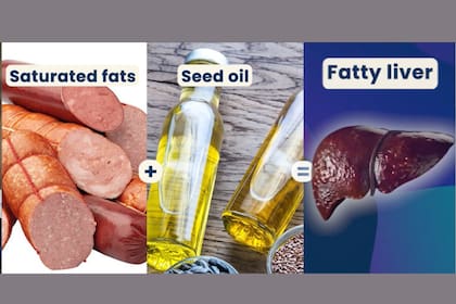 Las grasas saturadas y los aceites de semillas son alimentos nocivos para el hígado. (YouTube)