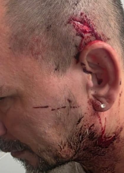 Las heridas de la víctima tras ser agredido por el conductor de la camioneta.