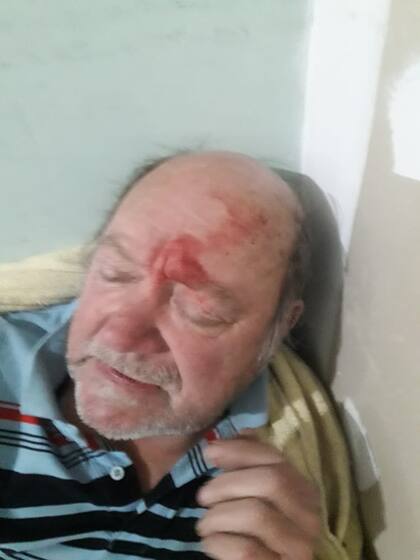 Las heridas que recibió el herrero Jorge Adolfo Ríos