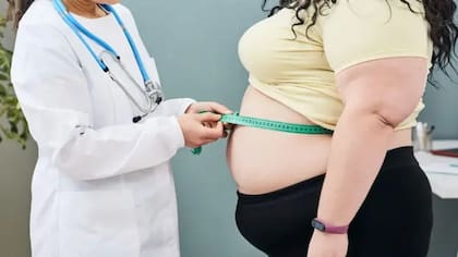 Las hernias de hiato son más comunes en mujeres y personas con sobrepeso