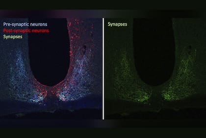 Las imágenes obtenidas de neuronas pre y post sinápticas del cerebro del ratón durante el estudio