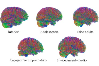 Las imágenes son representativas del patrón general observado en los cerebros del estudio durante cada etapa de conexión neuronal