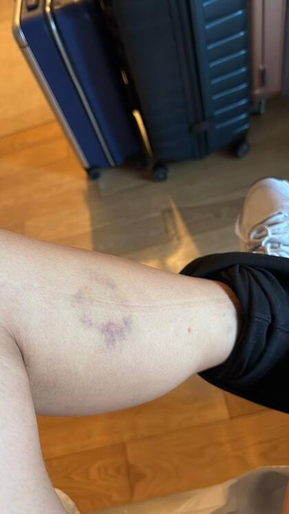 Las lesiones que reportó Mila Piercecchi