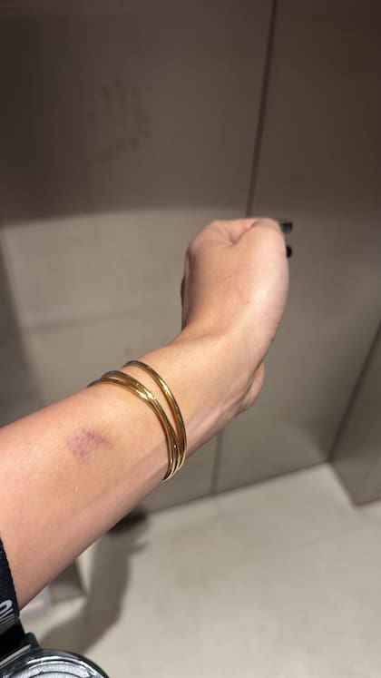 Las lesiones que reportó Mila Piercecchi