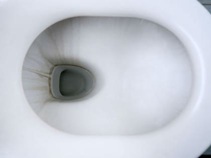 Las manchas marrones en los inodoros generan un profundo rechazo en las personas que habitan en una casa