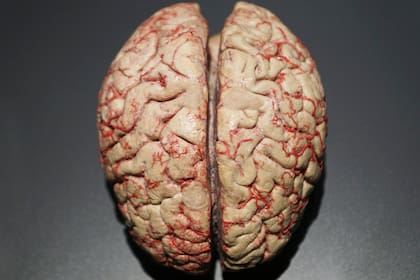 Las mejoras cognitivas son más evidentes en privación de sueño o estrés metabólico que en adultos jóvenes sanos