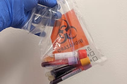 Las muestras de sangre y plasma son analizadas por el laboratorio de Columbia