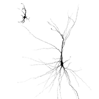 Las neuronas humanas creadas a partir de células madre y trasplantadas en el cerebro de una rata (derecha) crecen más plenamente que las cultivadas en un laboratorio (izquierda)