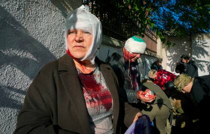 Las personas reciben tratamiento médico en el lugar del bombardeo ruso, en Kiev