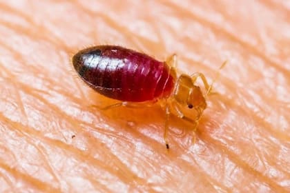 Las picaduras de chinches pueden ser un problema incómodo, especialmente cuando generan una intensa picazón (Imagen ilustrativa)