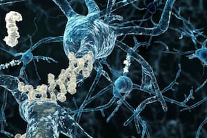 Aprueban una nueva droga para las etapas tempranas del Alzheimer: podría demorar el deterioro cognitivo