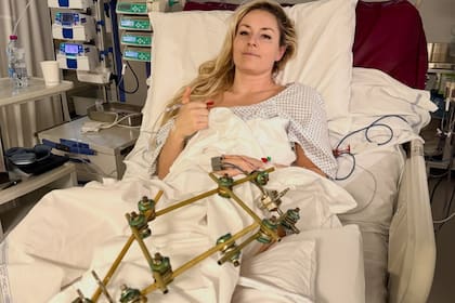 Las primeras imágenes de Lindsey Vonn, quien estuvo a punto de sufrir la amputación de una de sus piernas