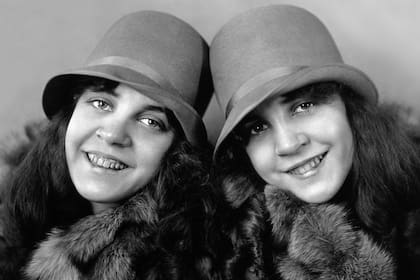 Las siamesas Daisy y Violet Hilton nacieron el 5 de febrero de 1908 en Sussex, Inglaterra, casi cien años antes que las mediáticas Nicky y Paris Hilton, herederas del magnate hotelero Conrad Hilton