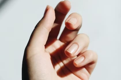 Las uñas con hongos se puede prevenir fácilmente (Foto Unsplash)