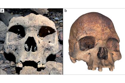 Las víctimas no tenían incisivos y eso modificó el aspecto de su cara