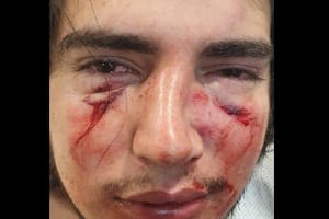 Córdoba: van a juicio dos rugbiers que desfiguraron a golpes un joven