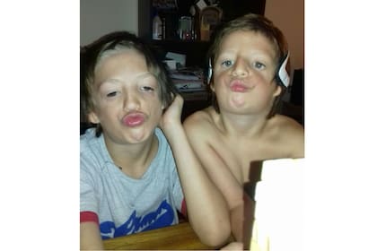 El único cuidado que deben tener Lautaro y Mirko es durante el deporte, ya que los audífonos que utilizan son costosos. Fuera de eso, hacen vida normal. “A mí lo único que me cuesta es levantarme temprano”, dice el más pequeño