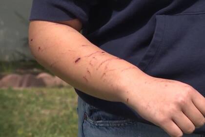 Leones marinos mordieron a diferentes personas en la costa de California alterados por una toxina