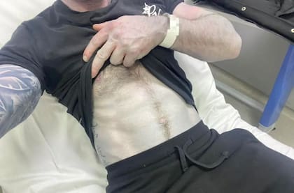 Lo que más preocupaba a los médicos es que el hombre pudiera tener un problema sanguíneo