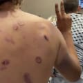 Las impactantes imágenes de los activistas de la flotilla que se viralizaron tras las denuncias de tortura contra Israel