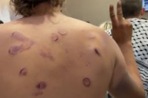Las impactantes imágenes de los activistas de la flotilla que se viralizaron tras las denuncias de tortura contra Israel