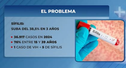 Los angustiantes números del sífilis en la actualidad